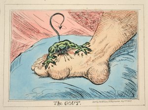 The Gout